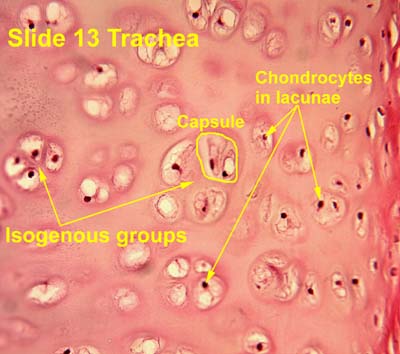 Lacunae Cartilage